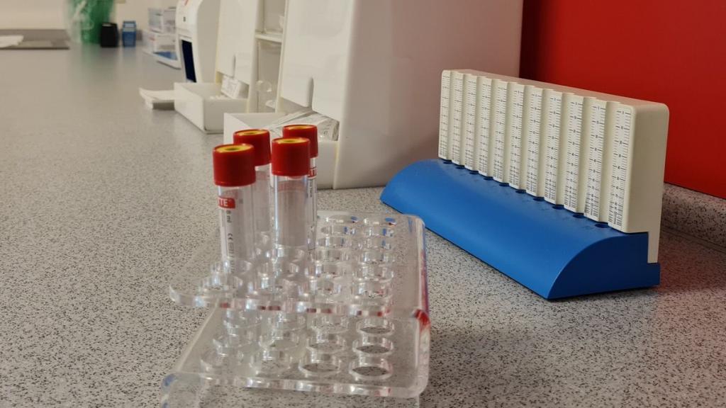 Bild aus dem Labor mit Arbeitsfläche, Blutentnahmeröhrchen